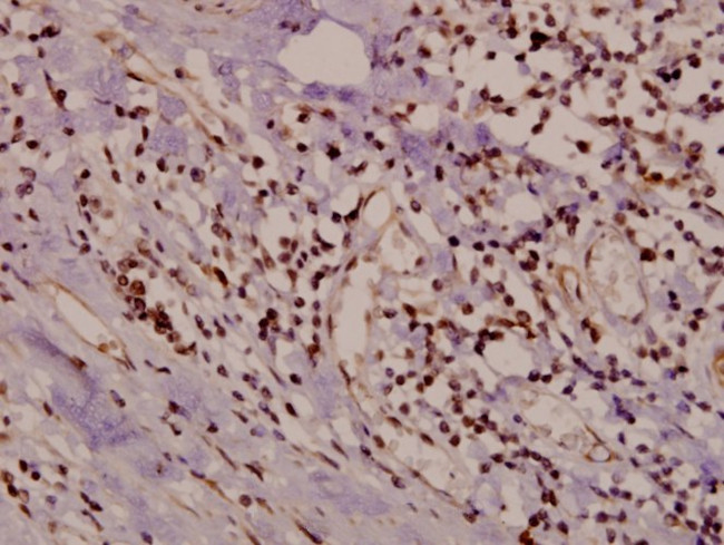 HSPB2 Antibody in Immunohistochemistry (Paraffin) (IHC (P))