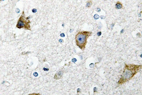 RPS20 Antibody in Immunohistochemistry (Paraffin) (IHC (P))