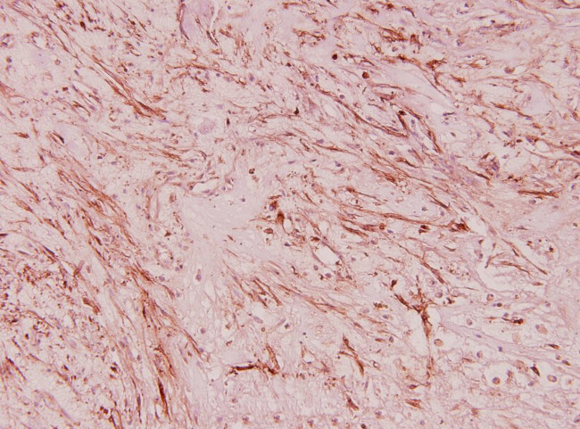 RPL36 Antibody in Immunohistochemistry (Paraffin) (IHC (P))