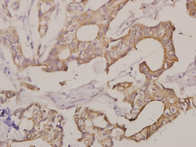 Apolipoprotein L1 Antibody in Immunohistochemistry (Paraffin) (IHC (P))