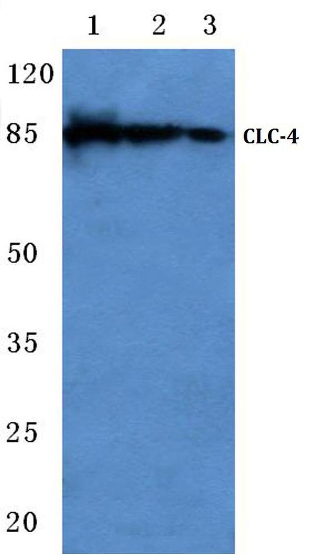 CLCN4 Antibody in Western Blot (WB)