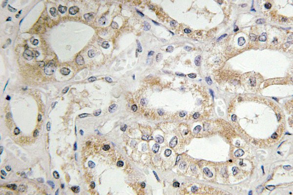 GRB14 Antibody in Immunohistochemistry (Paraffin) (IHC (P))