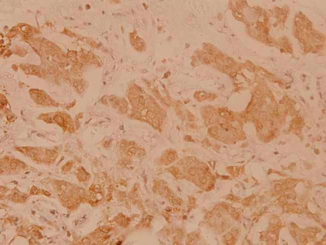 HLA-DOA Antibody in Immunohistochemistry (Paraffin) (IHC (P))