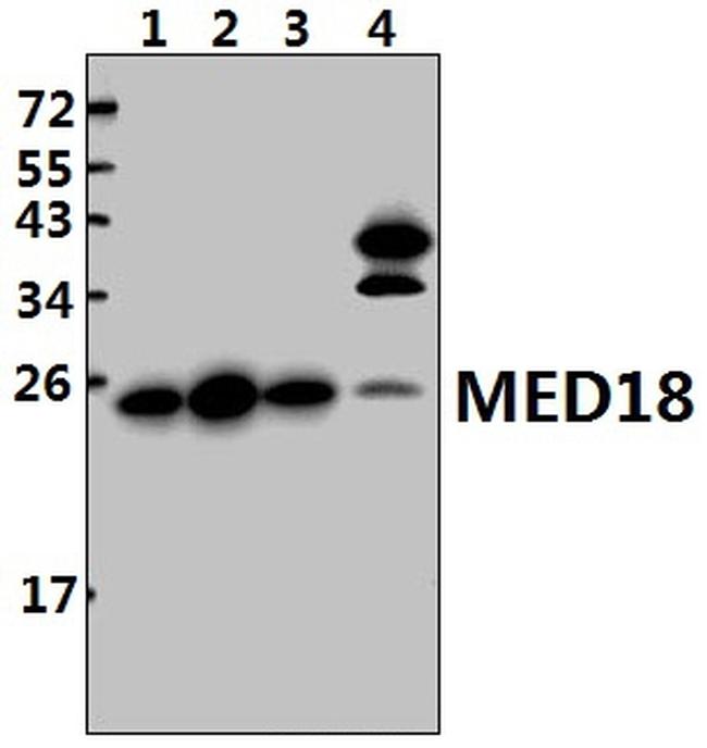 MED18 Antibody in Western Blot (WB)