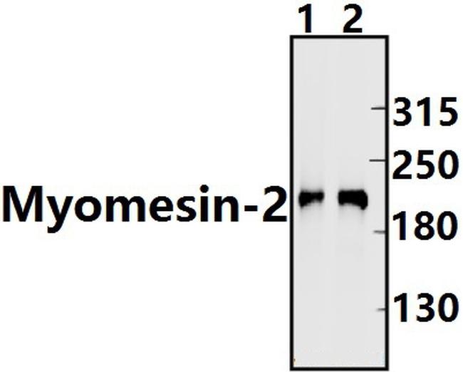 MYOM2 Antibody in Western Blot (WB)
