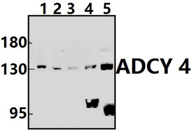 Adenylate Cyclase 4 Antibody in Western Blot (WB)
