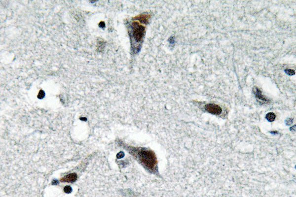 RFC3 Antibody in Immunohistochemistry (Paraffin) (IHC (P))