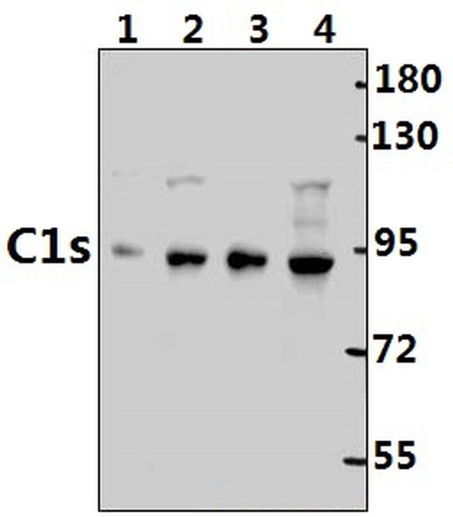 C1S Antibody in Western Blot (WB)