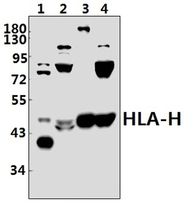 HFE Antibody in Western Blot (WB)