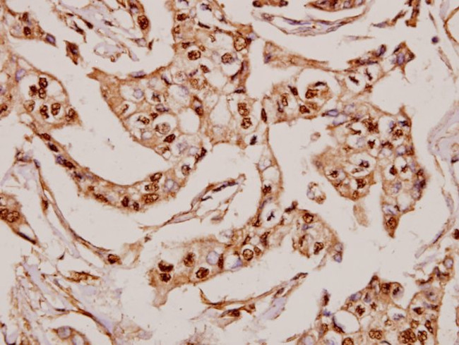 MRPS36 Antibody in Immunohistochemistry (Paraffin) (IHC (P))