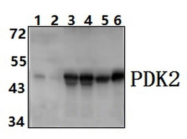 PDK2 Antibody in Western Blot (WB)