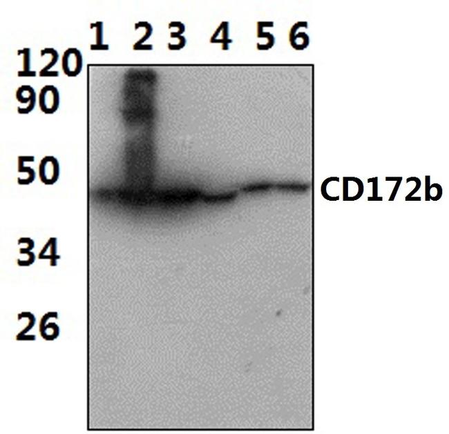 SIRPB1 Antibody in Western Blot (WB)