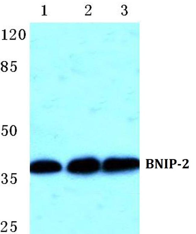 BNIP2 Antibody in Western Blot (WB)