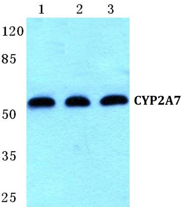 CYP2A7 Antibody in Western Blot (WB)