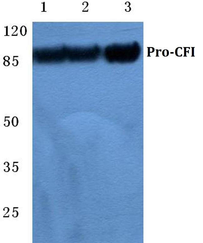Complement Factor I Antibody in Western Blot (WB)
