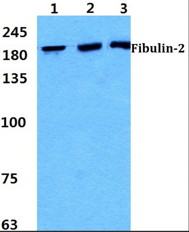 Fibulin 2 Antibody in Western Blot (WB)