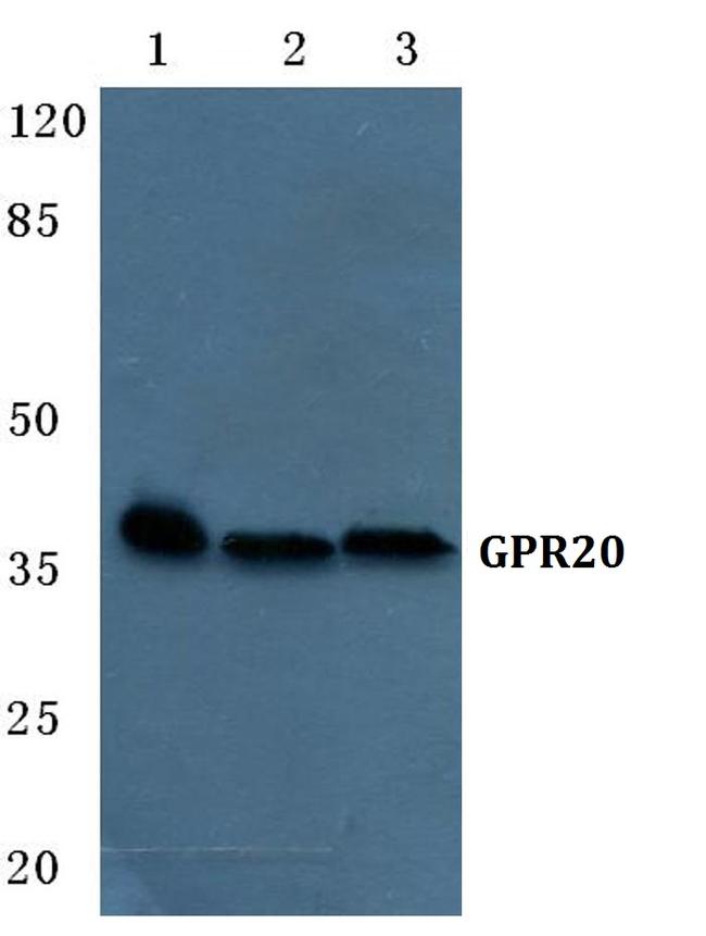 GPR20 Antibody in Western Blot (WB)