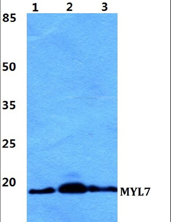 MYL7 Antibody in Western Blot (WB)