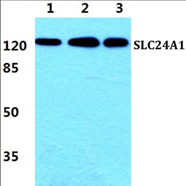 SLC24A1 Antibody in Western Blot (WB)