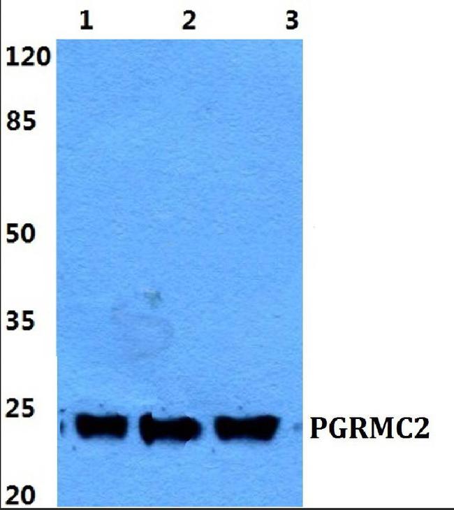 PGRMC2 Antibody in Western Blot (WB)