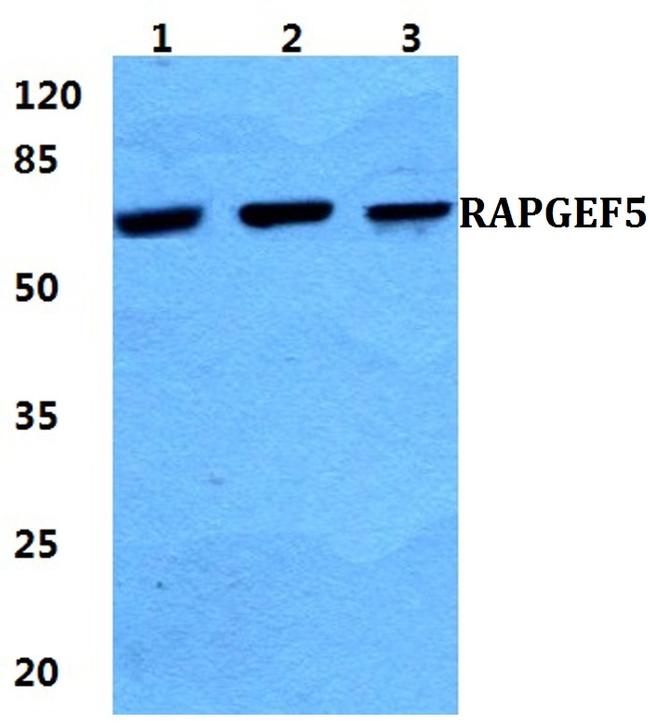 RAPGEF5 Antibody in Western Blot (WB)