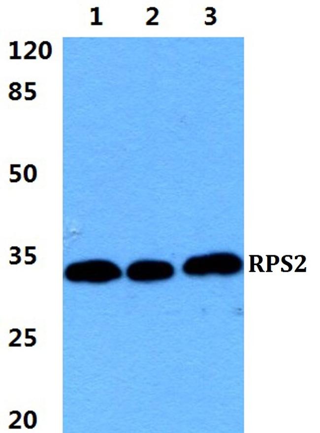 RPS2 Antibody in Western Blot (WB)