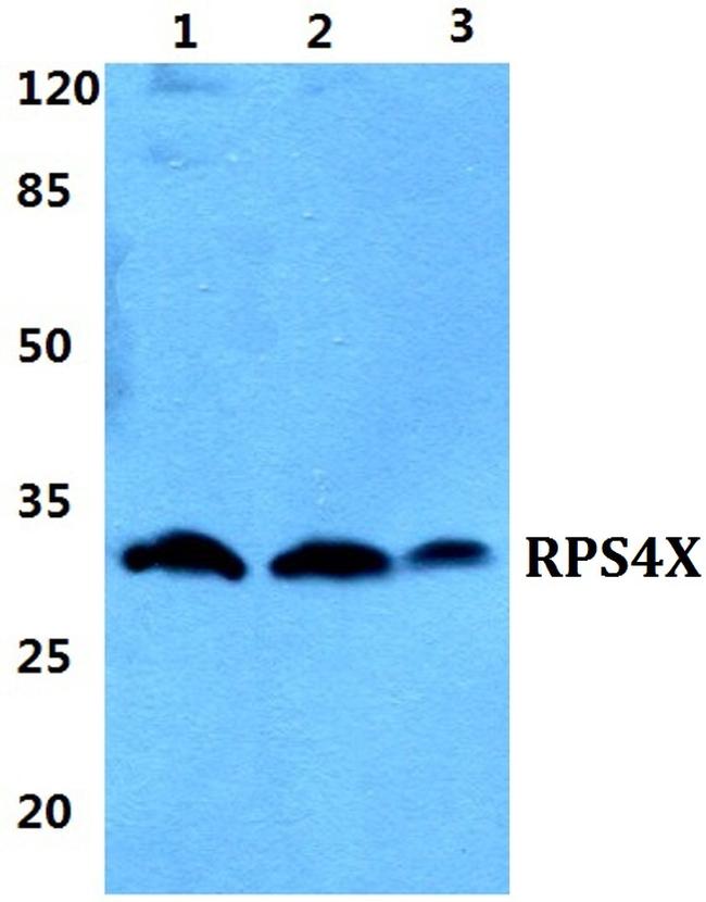 RPS4X Antibody in Western Blot (WB)