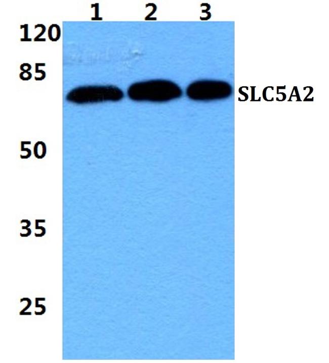 SGLT2 Antibody in Western Blot (WB)