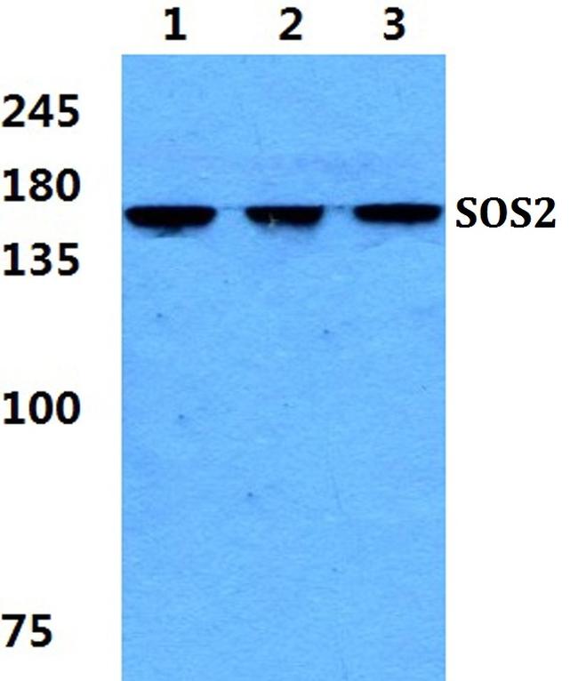 SOS2 Antibody in Western Blot (WB)