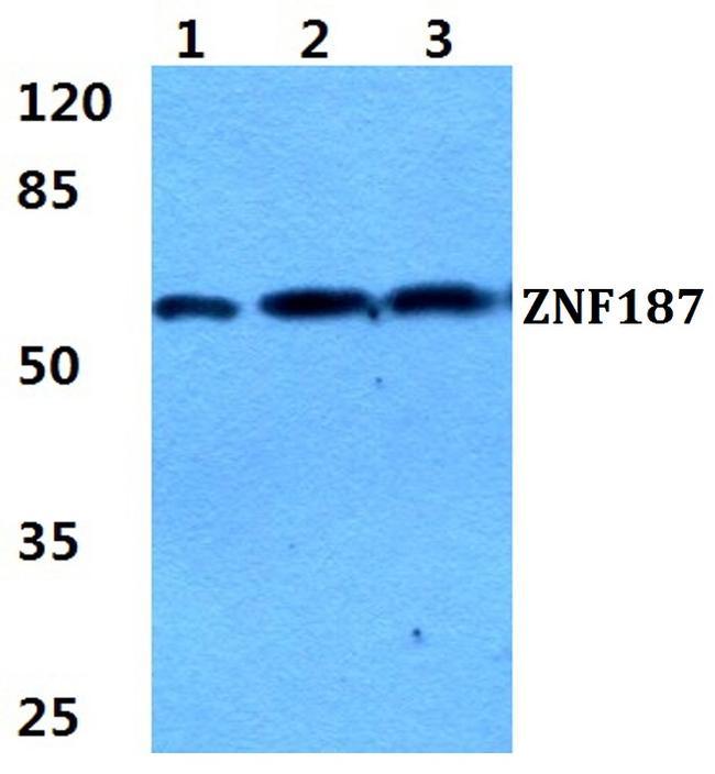 ZNF187 Antibody in Western Blot (WB)