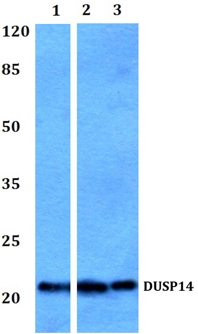 DUSP14 Antibody in Western Blot (WB)