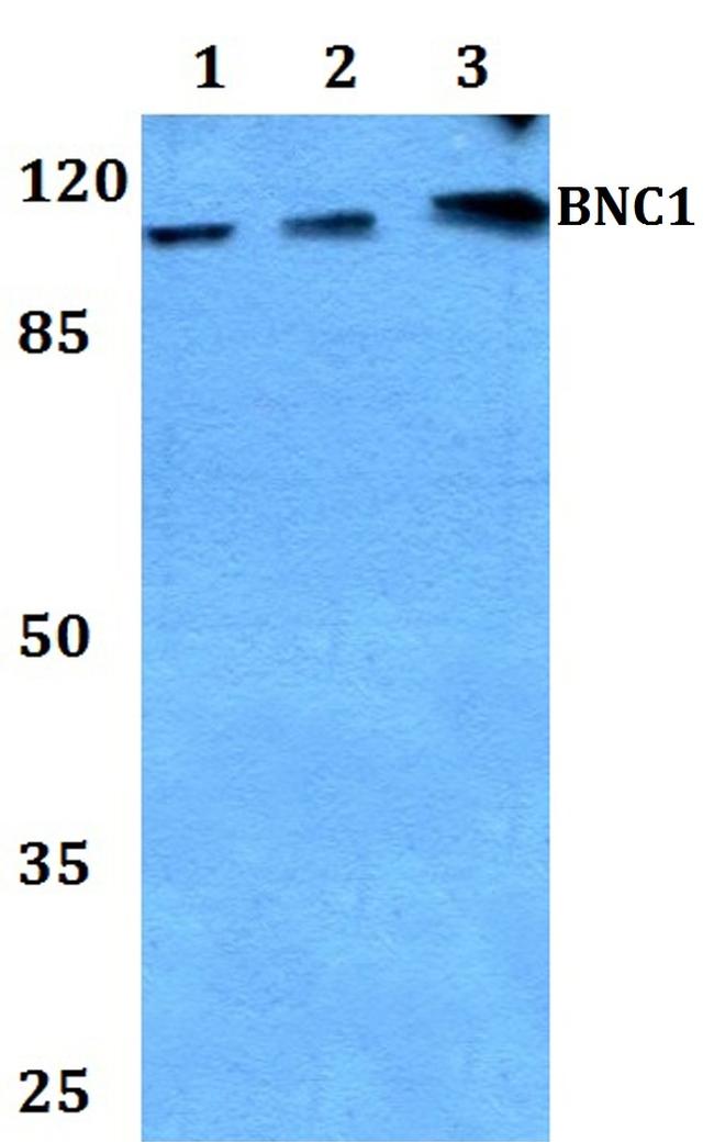 BNC1 Antibody in Western Blot (WB)