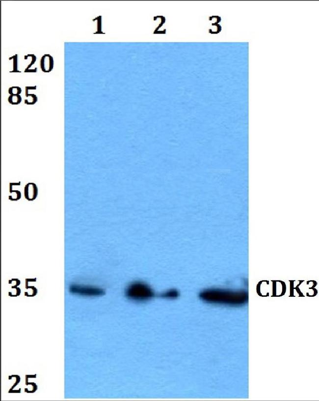 CDK3 Antibody in Western Blot (WB)