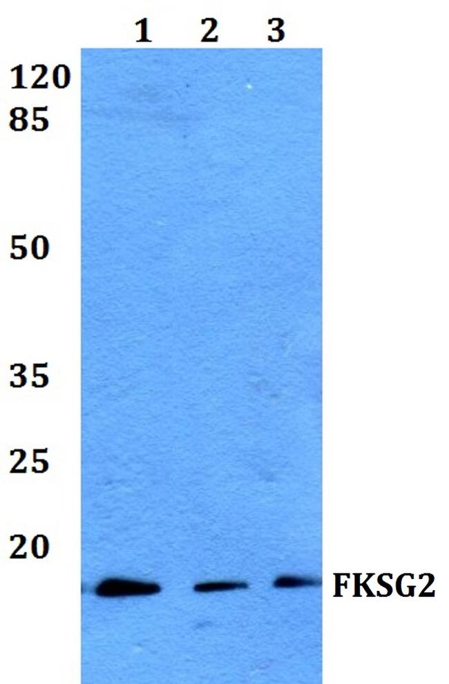 FKSG2 Antibody in Western Blot (WB)