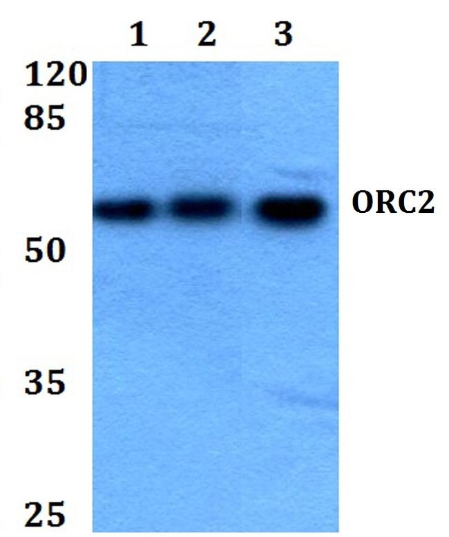 ORC2 Antibody in Western Blot (WB)