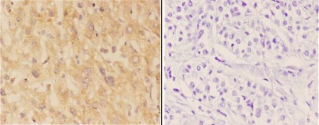 ASAH3 Antibody in Immunohistochemistry (Paraffin) (IHC (P))