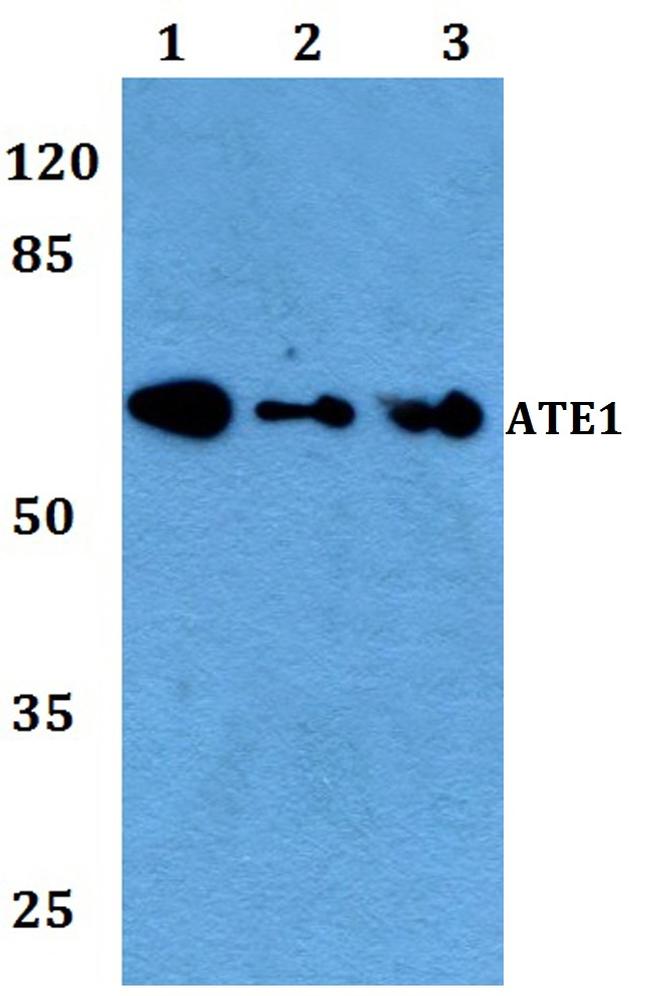 ATE1 Antibody in Western Blot (WB)
