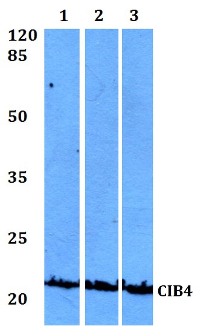 CIB4 Antibody in Western Blot (WB)