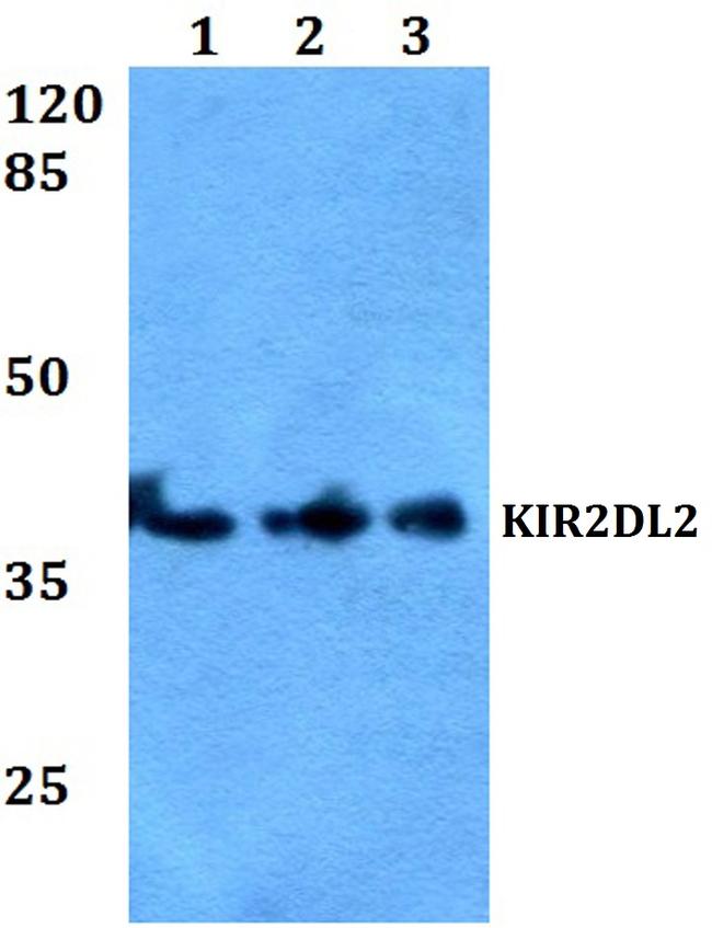 KIR2DL2 Antibody in Western Blot (WB)
