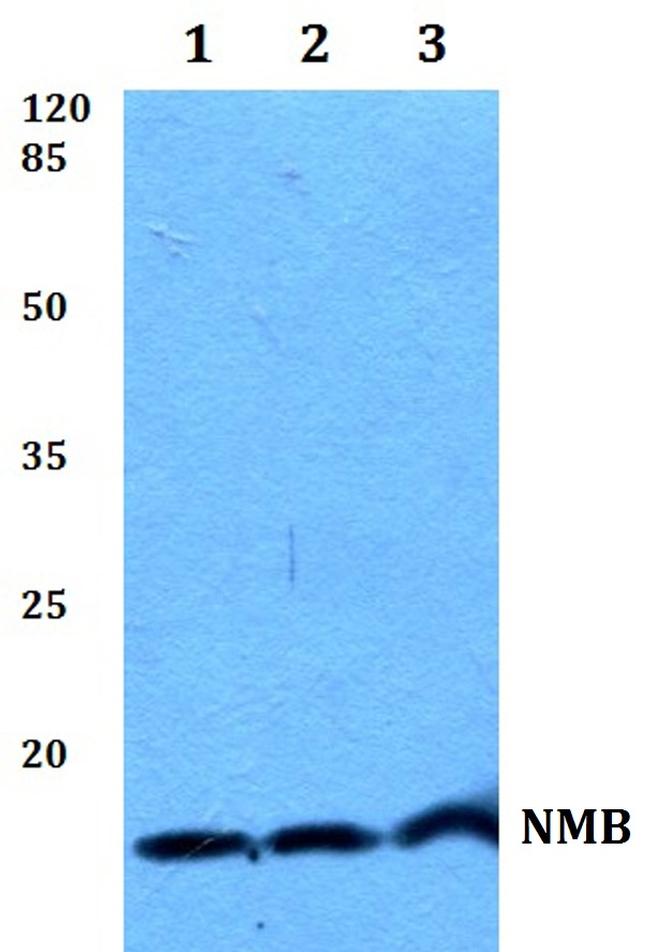 NMB Antibody in Western Blot (WB)