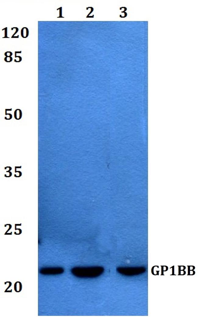 GP1BB Antibody in Western Blot (WB)