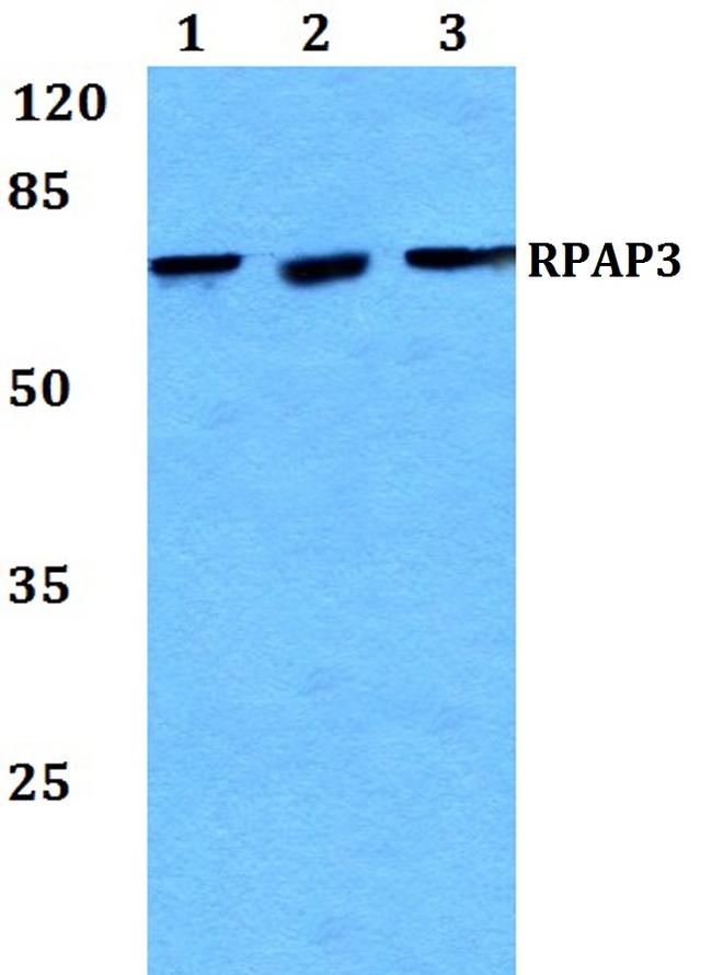 RPAP3 Antibody in Western Blot (WB)