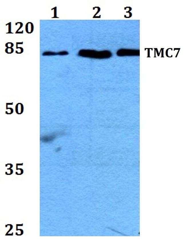 TMC7 Antibody in Western Blot (WB)