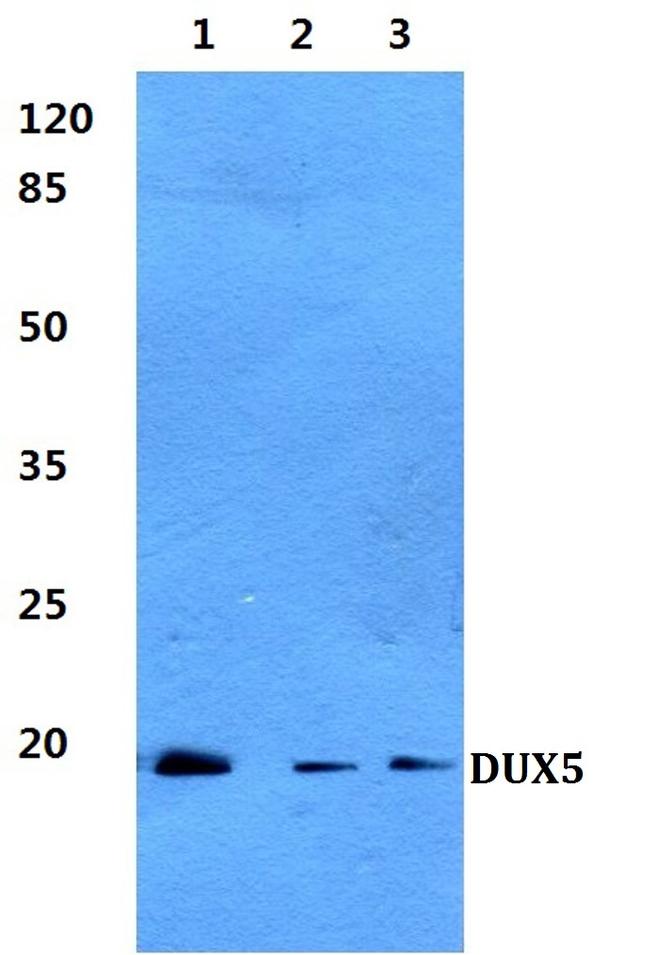 DUX5 Antibody in Western Blot (WB)