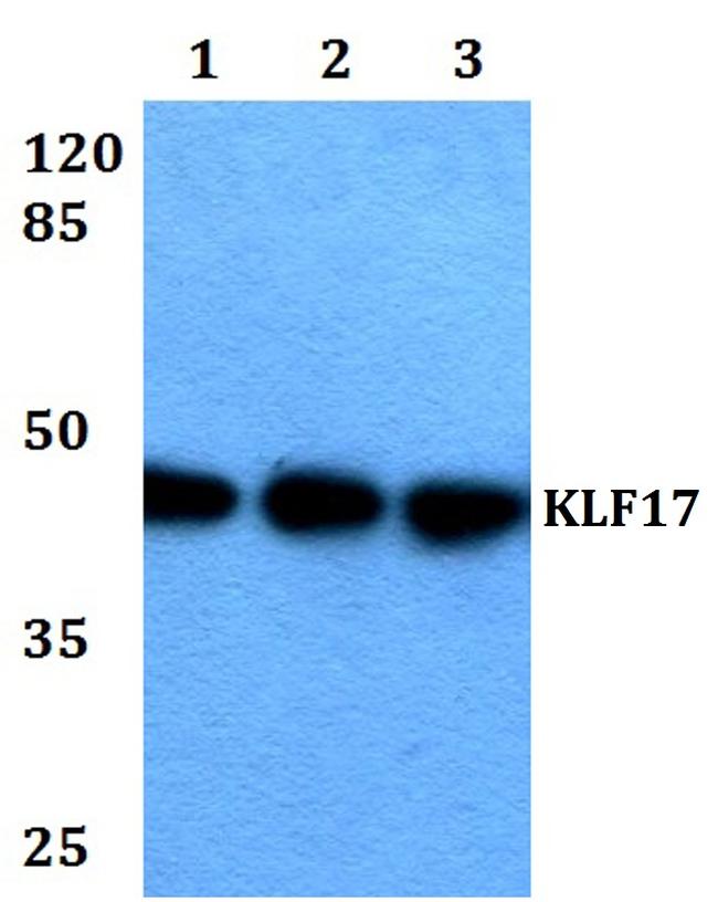KLF17 Antibody in Western Blot (WB)