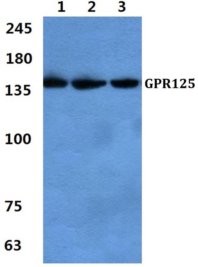 GPR125 Antibody in Western Blot (WB)
