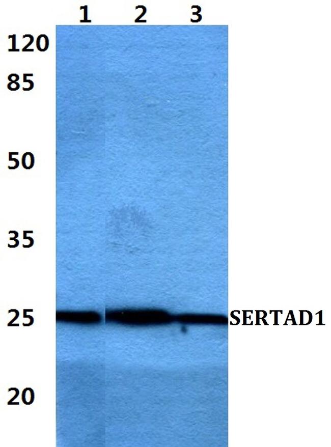 SERTAD1 Antibody in Western Blot (WB)