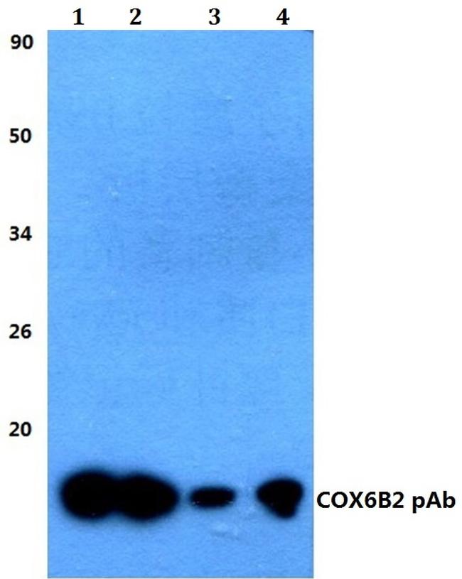 COX6B2 Antibody in Western Blot (WB)