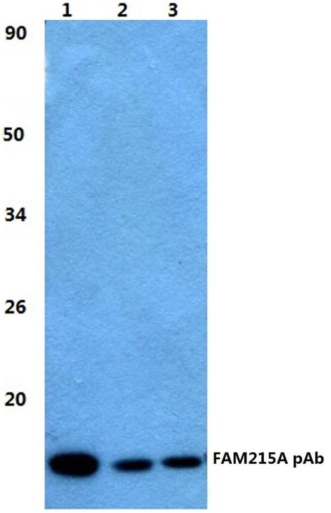 FAM215A Antibody in Western Blot (WB)