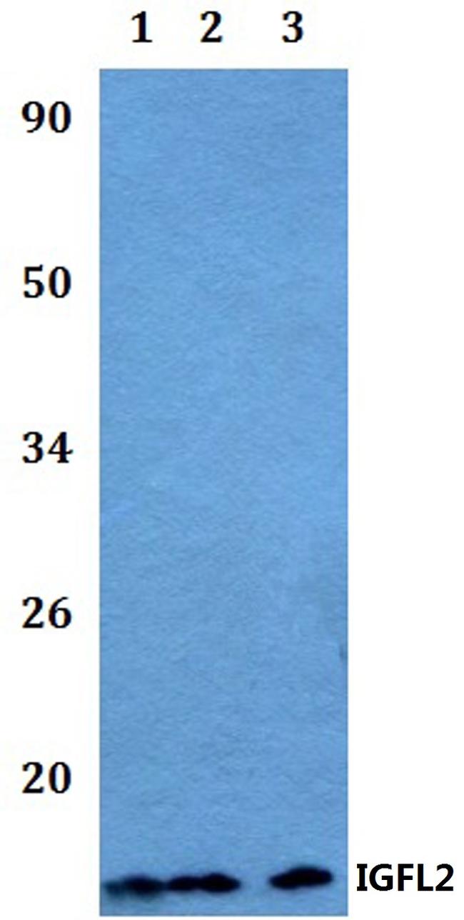 IGFL2 Antibody in Western Blot (WB)